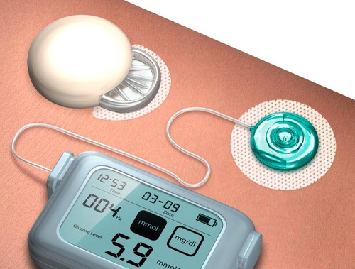 History of diabetes: early science, early treatment, insulin